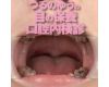 We have observed the throat Jeongja and silver tooth with a clos