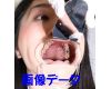 Teeth of Mari Photo