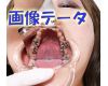 Teeth of Yui2Photo