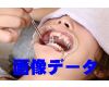 Teeth of Miyuki Photo