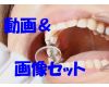 Teeth of Haru RETURNSMovie&Photo