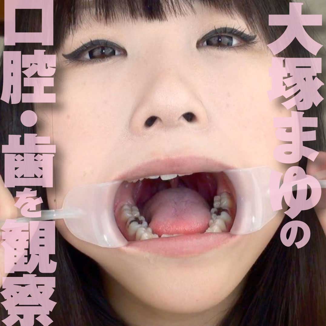 【歯フェチ口腔フェチ】大塚まゆちゃんの口腔内を観察しました