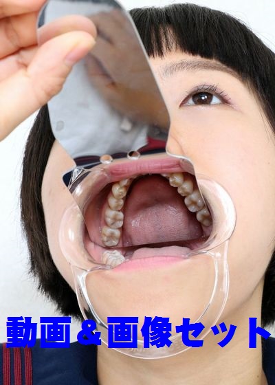 慶子ちゃんの歯　★★動画＆画像セット★★ 歯磨きがめんどくさーい　