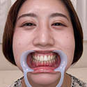 【歯フェチ】佐々木咲和ちゃんの歯を観察しました！