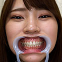 【歯フェチ】竹内夏希ちゃんの歯を観察しました！