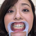 【歯フェチ】牧村彩香さんの歯を観察しました！