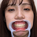 【歯フェチ】福田ももちゃんの歯を観察しました！