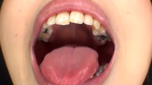 横山夏希の口内・銀歯・ベロ唾液全て見せます。