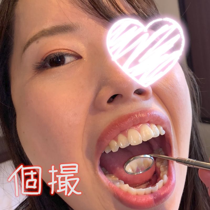 【個人撮影】現役ソープ嬢の歯の裏には歯垢が詰まってたｗ　さおり【Y-052】