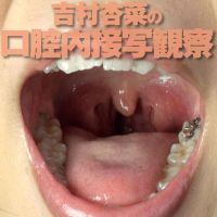 The oral cavity of Yoshimura Anna-chan wearing the opener, and c