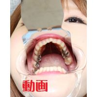 Teeth of KarenMovie