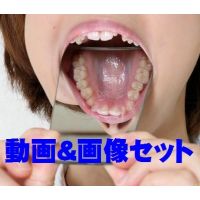anri teeth movie&Photo