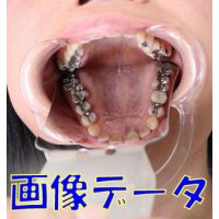 Teeth of Shizuka Photo