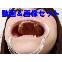 Teeth of RikaMovie & photo