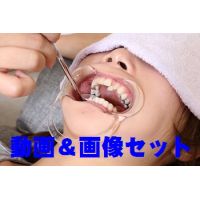 Teeth of Miyuki MoviePhoto