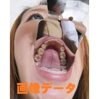 Teeth of misa Photo