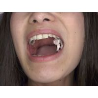 haruka teeth