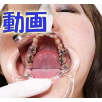 Teeth of Yui2 Movies