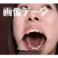 Teeth of HinanoPhoto