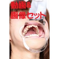Teeth of NagisaMoviePhoto