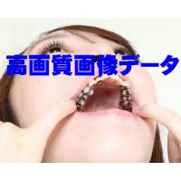 Teeth of saki45 sheetsHigh resolutionphoto data