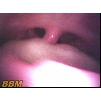 Beauty of teeth and uvula 4