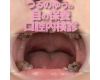 We have observed the throat Jeongja and silver tooth with a clos