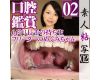 Intraoral appreciation of the opening device mounted Megumi-chan