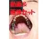 Teeth of Shiho　Movie & Photo