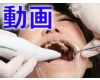 すみれちゃんの銀歯と欠損2 動画「歯医者行ったら全部銀歯に・・・」　