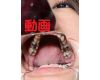 Teeth of Aoi　Movie A&B