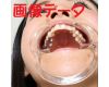 Teeth of Shiori　Photo