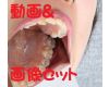 Teeth of Chiaki　Movie & Photo