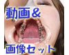 Teeth of Yui2 Movies＆Photo
