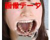 Teeth of Rika　Photo