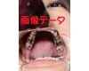 Teeth of Aoi photo