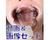 Teeth of Shizuka Movies&Photo