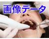すみれちゃんの銀歯と欠損2　画像データ　「歯医者行ったら全部銀歯に・・・」