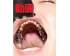 Teeth of Shiho　Movie