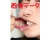 Teeth of Riho-again-Photo