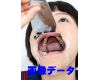 Teeth of KEIKO Photo