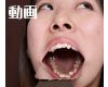 Teeth of Hinano　Movie