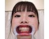 【歯フェチ】美波こづえちゃんの歯を観察しました！