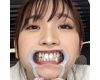 【歯フェチ】鈴木真夕ちゃんの歯を観察しました！
