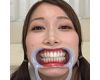 【歯フェチ】佐伯由美香さんの歯を観察しました！