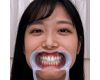 【歯フェチ】前乃菜々ちゃんの歯を観察しました！