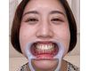 【歯フェチ】佐々木咲和ちゃんの歯を観察しました！