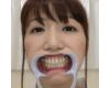 【歯フェチ】加藤あやのさんの歯を観察しました！