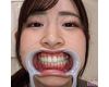 【歯フェチ】沙月恵奈ちゃんの歯を観察しました！