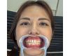 【歯フェチ】武藤あやかさんの歯を観察しました！